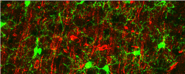 Exploring immunological manifestations that facilitate aging and age-related disease susceptibility